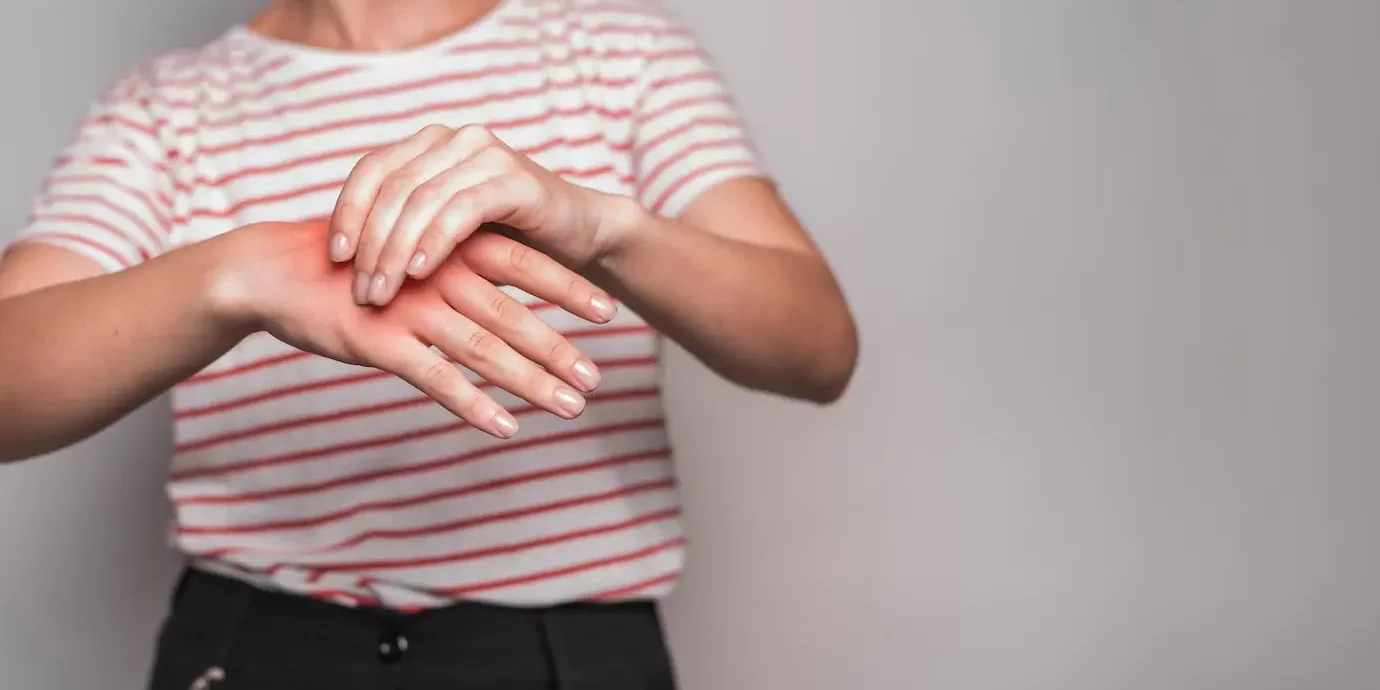 Carpal Tunnel Syndrome