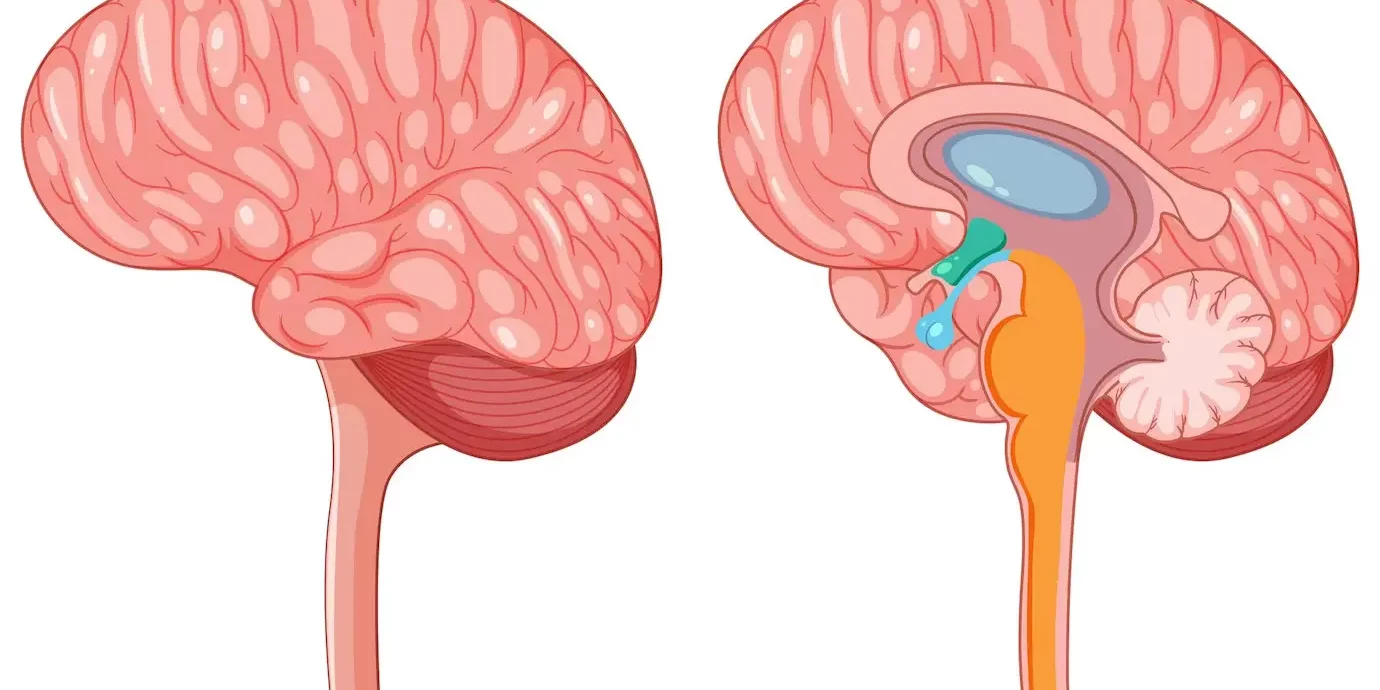 Cerebellopontine Angle Tumor