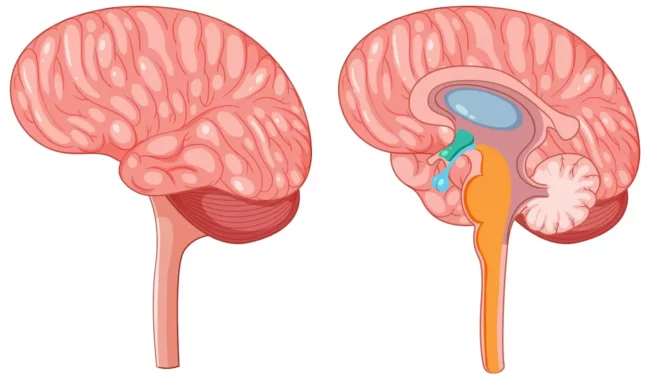 Cerebellopontine Angle Tumor