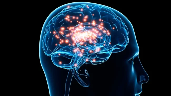 deep brain stimulation