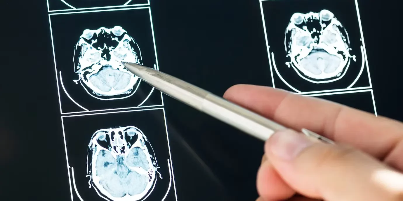 types of brain injuries